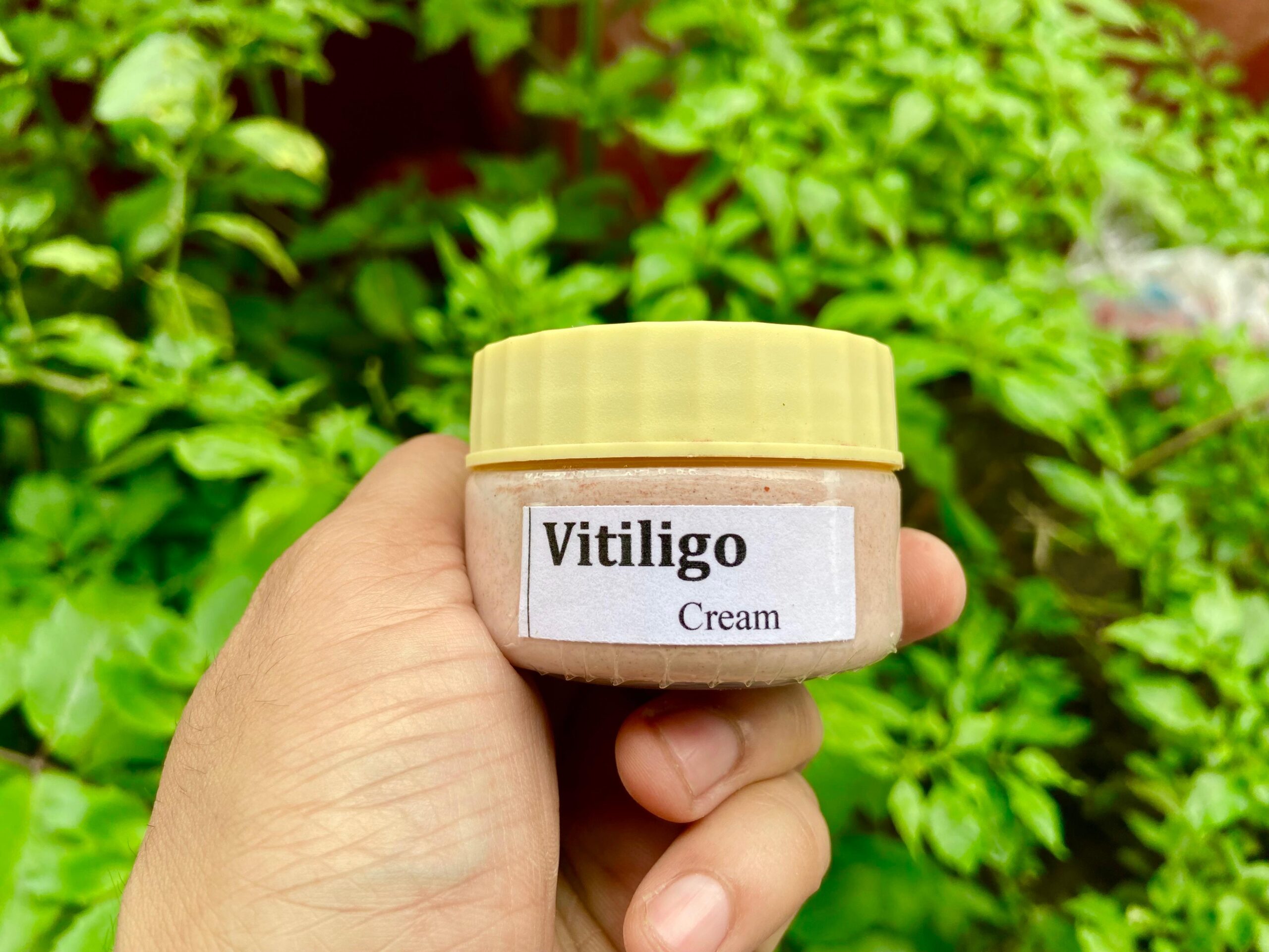 Ayurvedic Vitiligo Cure