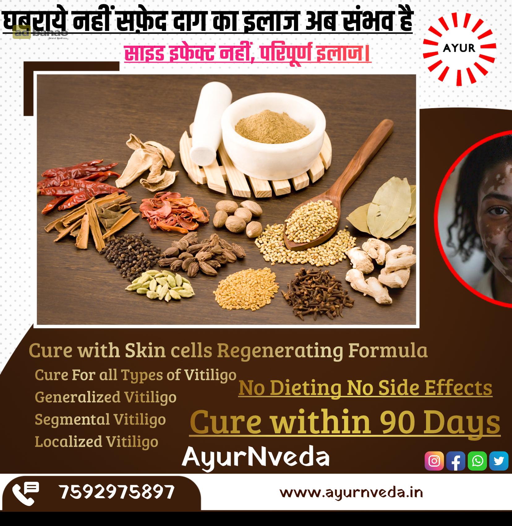 Ayurvedic Vitiligo Cure - Image 10